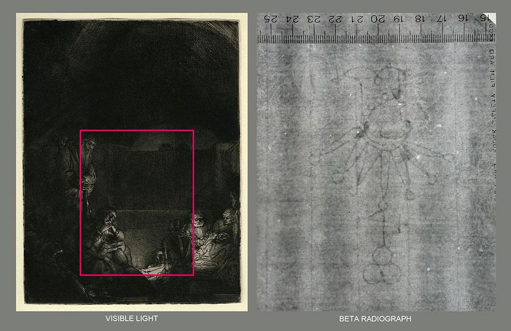 Print by Rembrandt under normal illumination and beta radiograph comparison
